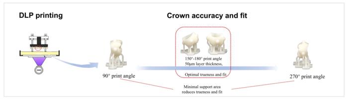 HOW PRINT ANGLE AND LAYER THICKNESS AFFECT THE ACCURACY AND FIT OF 3D-PRINTED RESIN-BASED CERAMIC CROWNS.