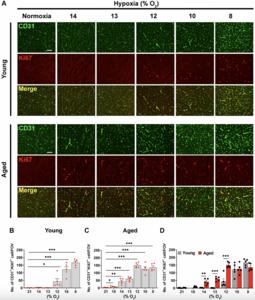 Defining the hypoxic thresholds that trigger blood-brain barrier disruption: the effect of age