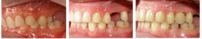 Teeth
