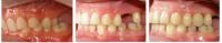 Teeth