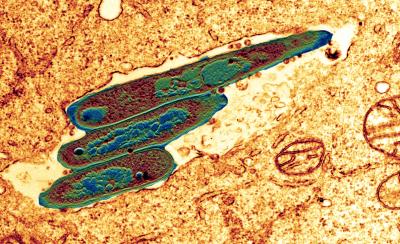 New Tuberculosis Vaccine