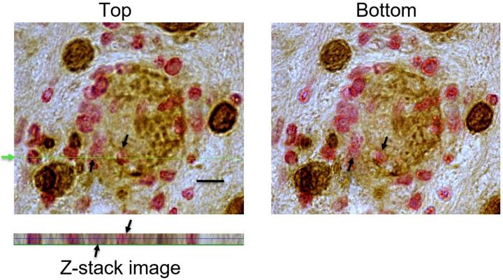 New Evidence Shows Cytotoxic T Cells Can Identify, Invade, and Destroy Targets of Large Cysts