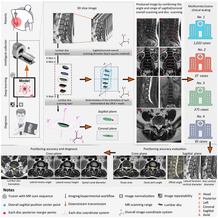 Figure 1 Workflow of the Lumbar VNet Pro system showing model training, MRI-integrated scan guidance, and multicenter clinical validation