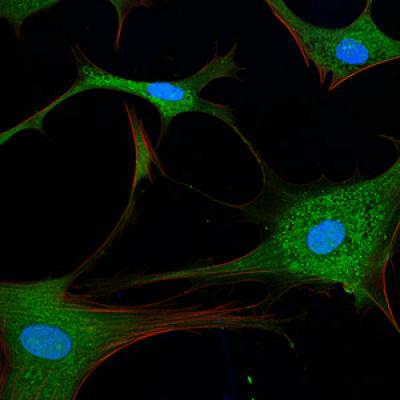 Autophagy