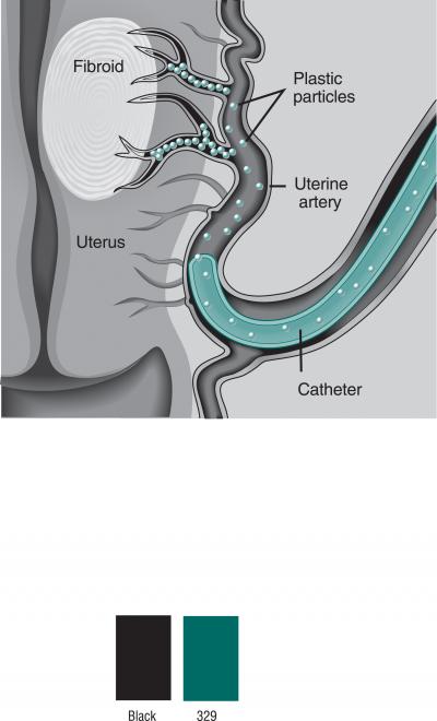 UFE: Closeup View