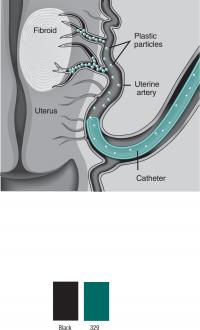 UFE: Closeup View