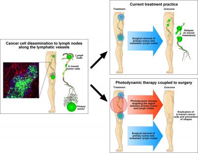 Targeting Intralymphatic Tumor Cells