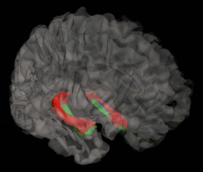 Hippocampus