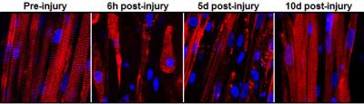 Sarcomere Recovery
