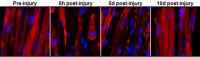 Sarcomere Recovery