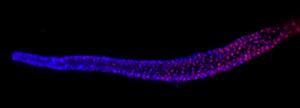 DNA hitchhiking in C. elegans