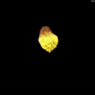 Kidney Development