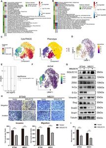 SIGLEC15 expression suppresses EMT and metastatic capacity in breast cancer.