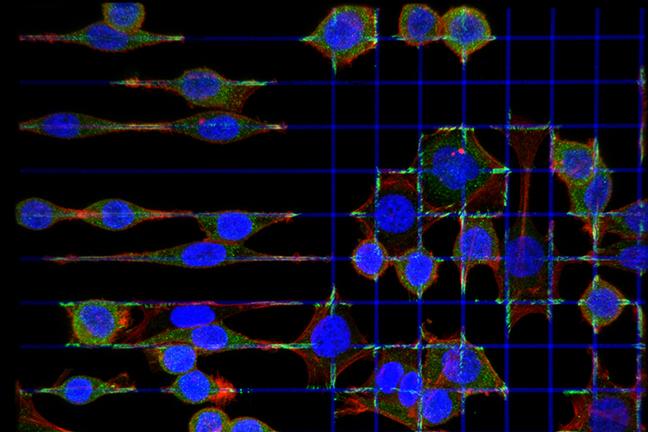 Cancer Cell Movements