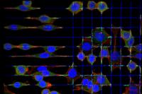 Cancer Cell Movements