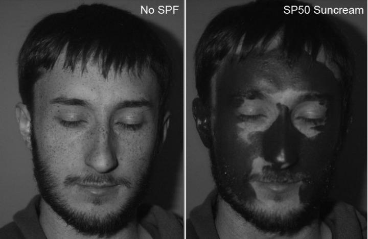 Before and After Sunscreen Application (2 of 2)