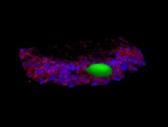 Measuring stress around cells