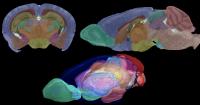 Brain from all Angles