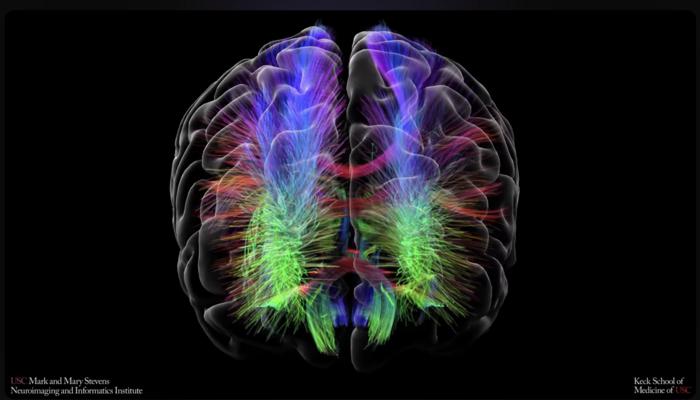 Brain graph