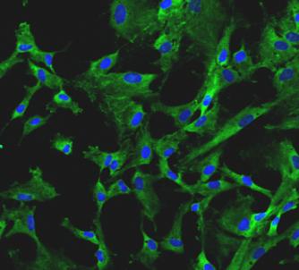 Cardiovascular Progenitor Cells (CPCs)