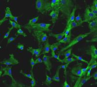 Cardiovascular Progenitor Cells (CPCs)