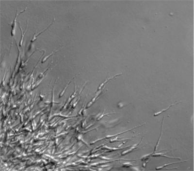 Interneurons Migrate to the Cerebral Cortex