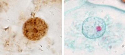 Study Indicates Royal Ferns Are 'Living Fossils' (8 of 10)