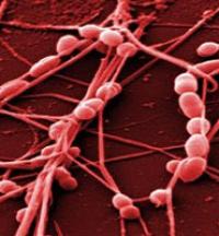 Streptococcus Bacteria (2 of 2)