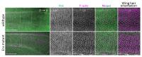 Map7/7D1 (Ens) in <i>Drosophila</i> is Involved in the Formation of PCP