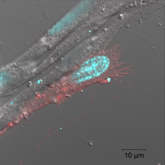 Heightened CD36 Activity