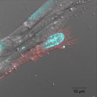 Heightened CD36 Activity