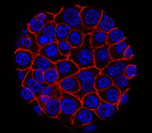 Pancreatic Cancer Cell