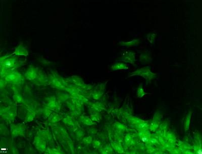 Fibroblasts