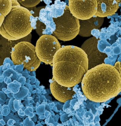<I>S. aureus</i> Bacteria