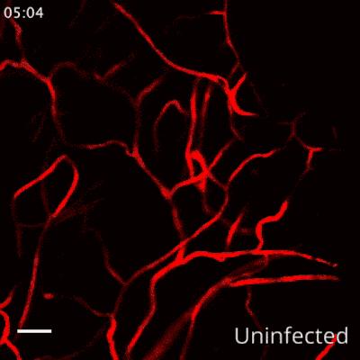 Tryptase Inhibition Reduces Vascular Leakage in Dengue Virus (DENV) Infected Preclinical Models