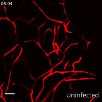 Tryptase Inhibition Reduces Vascular Leakage in Dengue Virus (DENV) Infected Preclinical Models