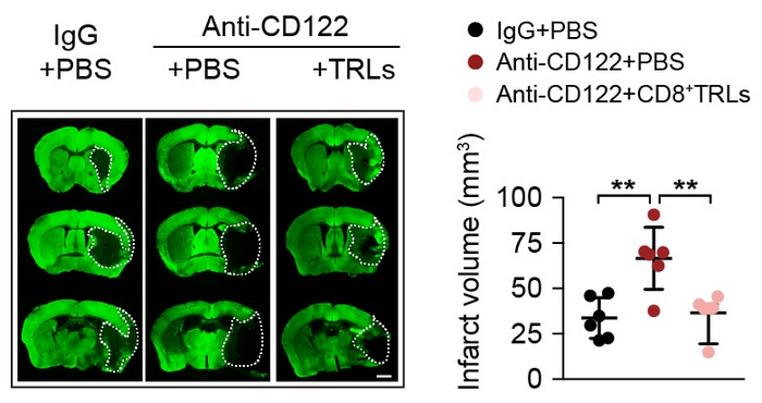 Brain regions affected by ischemia in stroke mice