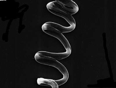 Coiled Fiber