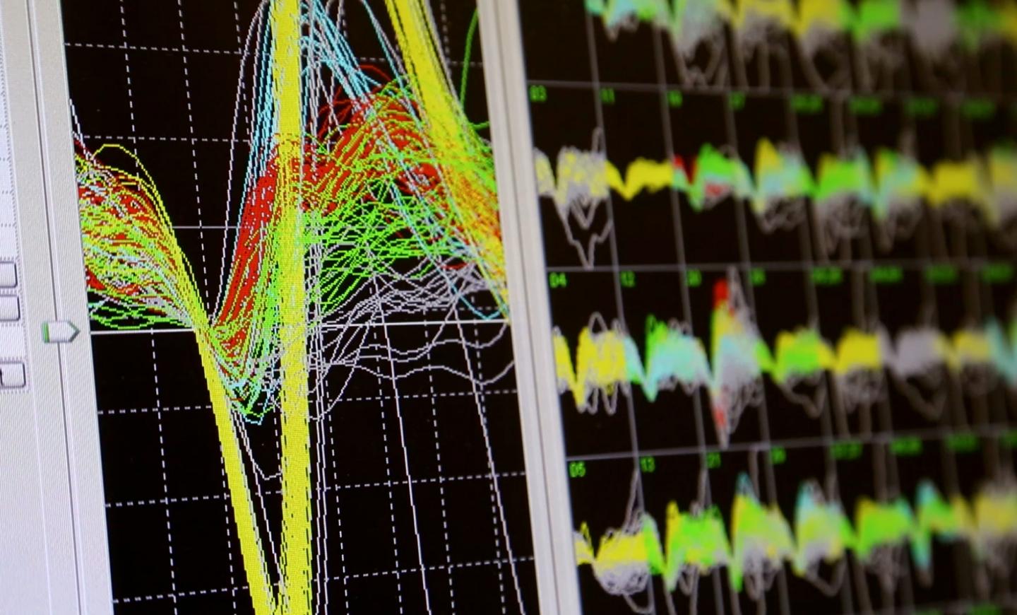 Brain-Machine Interfaces at Duke University