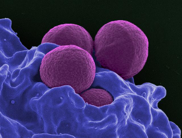 MRSA Bacteria