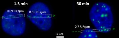 RIF in Breast Cells