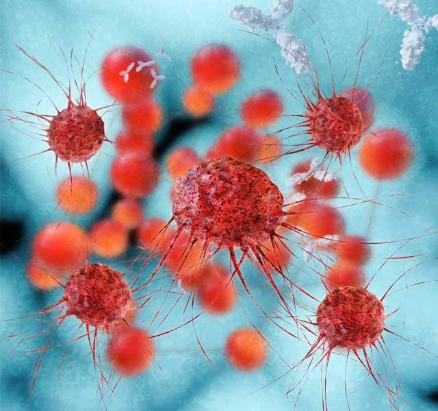 Cancer Cells