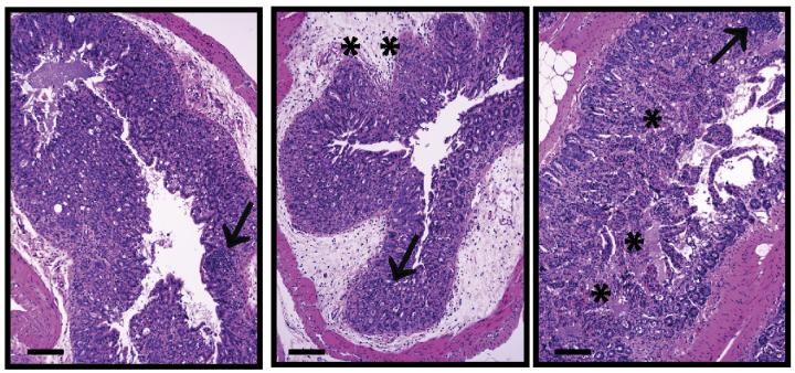 Obesity and Cancer Immunotherapy