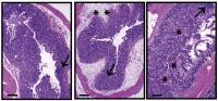Obesity and Cancer Immunotherapy