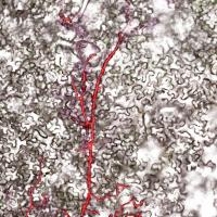 <I>Phytopthora infestans</I> Hypha