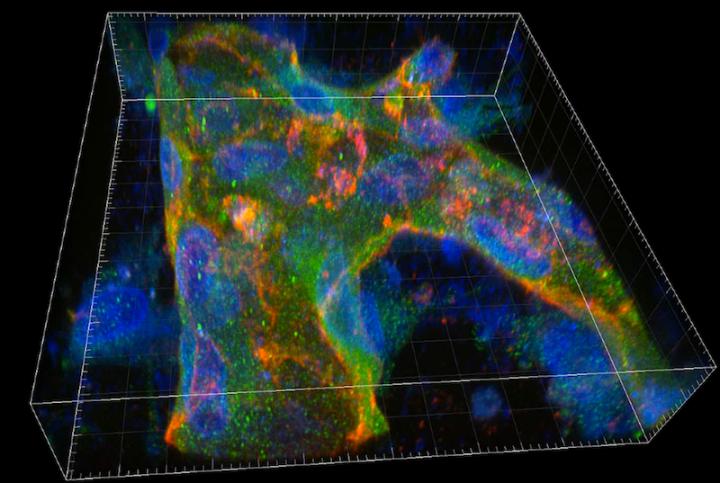 Living Blood Vessels Containing Sturge-Weber Syndrome's Genetic Mutation