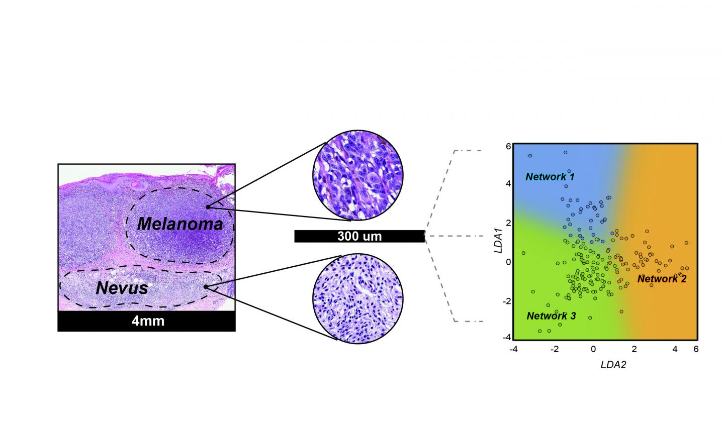 Novel Strategy Using microRNA Biomarkers Can Distinguish Melanomas