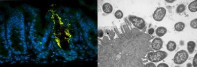 Invading Bacteria Attached to the Gut Lining