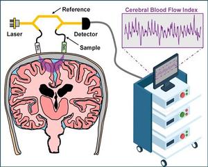 Interferometric diffusing wave spectroscopy