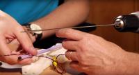 BendGuide Keeps Orthopedic Procedures on Target